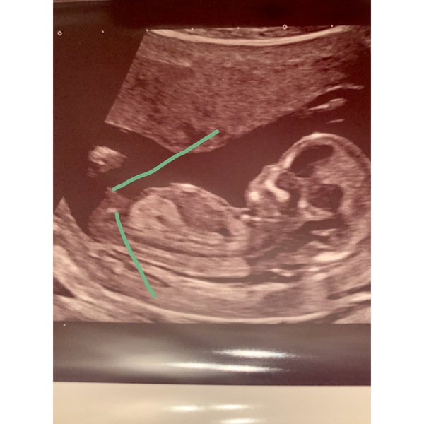 Yawn, another nub photo! I don’t understand it, any experts around?