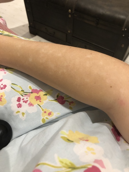 To ask WHAT IS WRONG WITH MY ARM?!?!