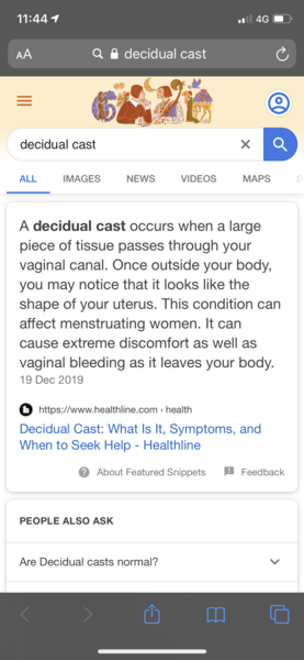 Is this a miscarriage? :( pic included warning