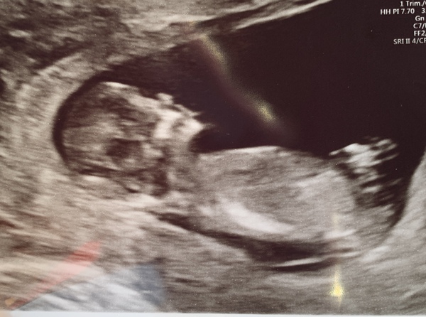 Moms due in august 2020!!