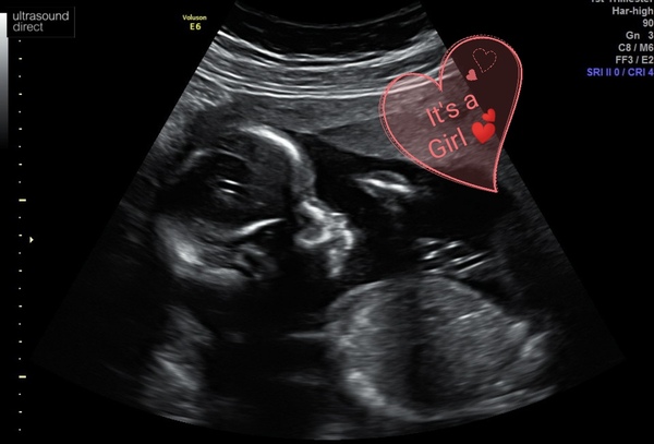 Due end of June/start of July 2020