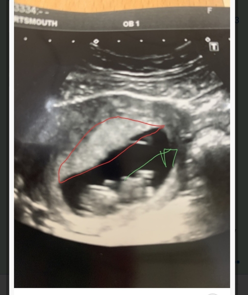 Any sonographers on here?! Pic attached