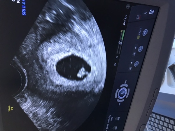 Early scan