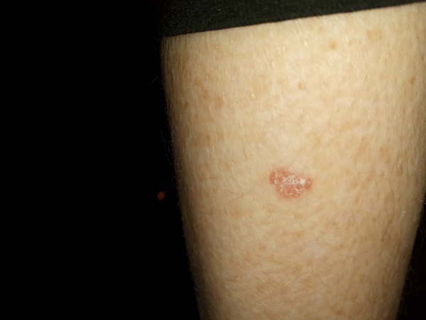 Skin related: does anyone know what this spot is?
