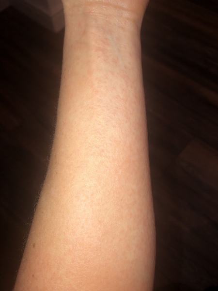 What is this rash that has suddenly appeared?