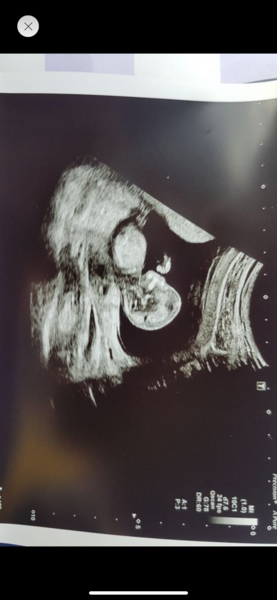 Boy or girl from 12 week scan?:)