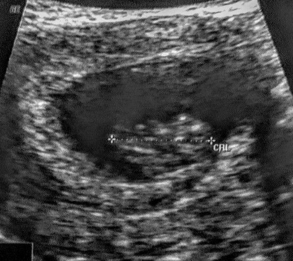 Early scan