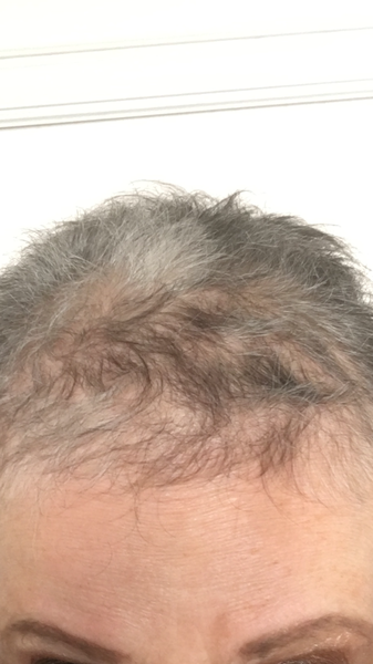 Cancer support thread #73 - come in, we're here for you.