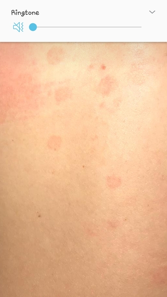 What's this weird Rash?