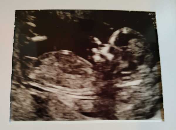 August/September Babies Thread 2