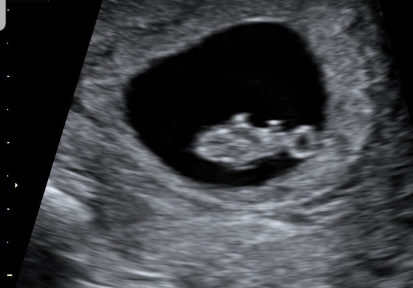 Early scan