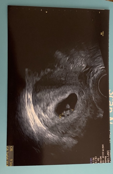 Today I found out I’m pregnant! Early Oct babies please join!