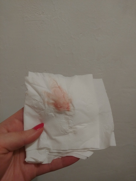 TTC after miscarriage - February 2020