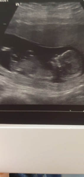 Gender guesses?