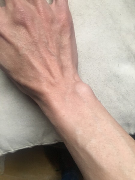 Lost nearly half a stone in 2 months, what to do?