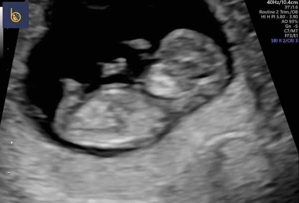 9 weeks pregnant. What is this???