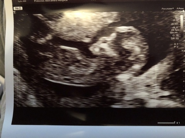Gender confusion? Pics included.