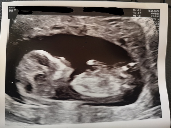 Anyone fancy a guess? Any sonographers?