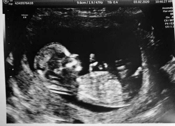 Anyone due August 2020 pt II