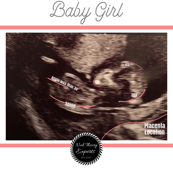 Gender confusion? Pics included.