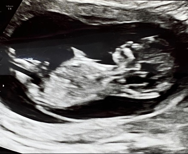 Boy or girl? ❤️