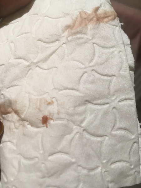 TTC after miscarriage