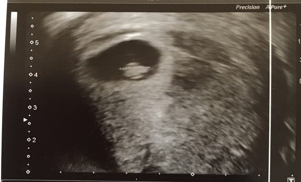 Dec19/Jan20 IVF Graduates