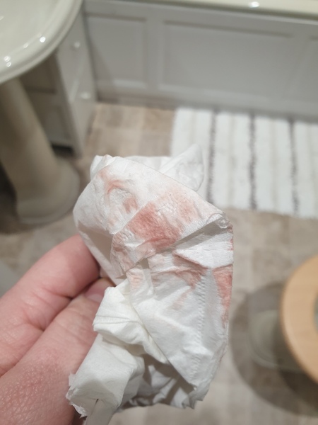 TTC after miscarriage - February 2020
