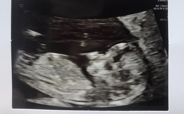 Gender guesses... just for fun
