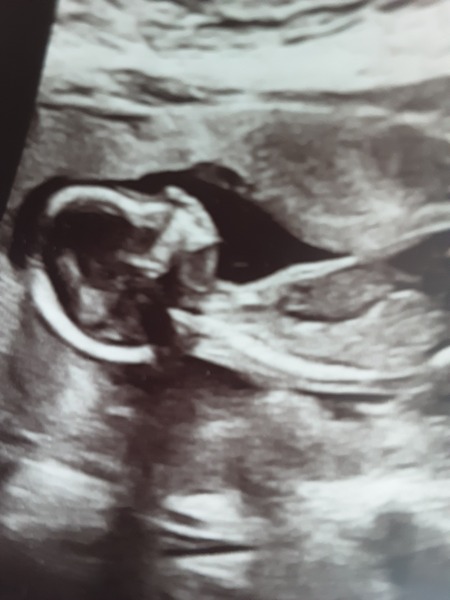 Due end of June/start of July 2020