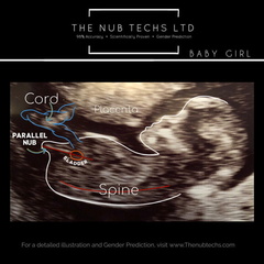 Gender confusion? Pics included.