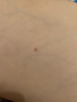 spots/ postules