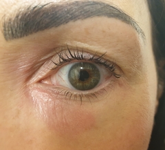 🐌 Fantastic Skincare: Is Everyone Having Botox Without Me? 💉