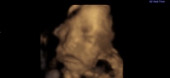 4d scans at 24 weeks?