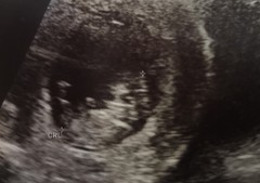 Pregnant after loss and dreaming of rainbows....