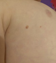 spots/ postules