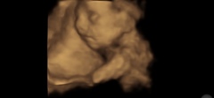 4d scans at 24 weeks?
