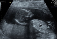 Any Sonographers (or anyone really) fancy a guess?