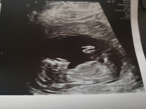 Anyone fancy a guess? Any sonographers?