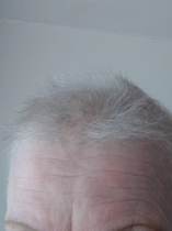 Cancer support thread #73 - come in, we're here for you.