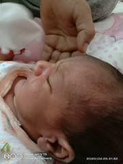 Red and white pimples over my baby's face, forehead, and head. Feeling concerned