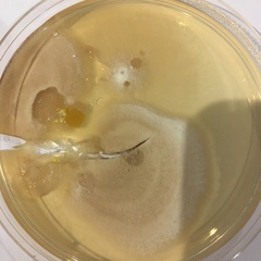 Anyone good at identifying germs on Agar plates?