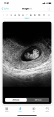 Today I found out I’m pregnant! Early Oct babies please join!
