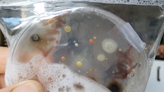 Anyone good at identifying germs on Agar plates?