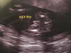 Gender confusion? Pics included.