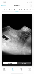Today I found out I’m pregnant! Early Oct babies please join!