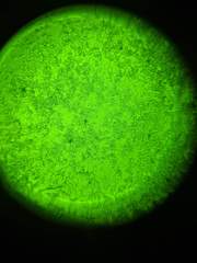 Anyone tried ferning to determine ovulation?