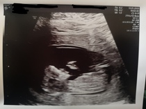 Anyone fancy a guess? Any sonographers?