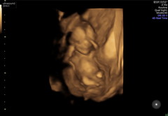 Any Sonographers (or anyone really) fancy a guess?