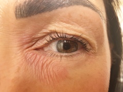 🐌 Fantastic Skincare: Is Everyone Having Botox Without Me? 💉